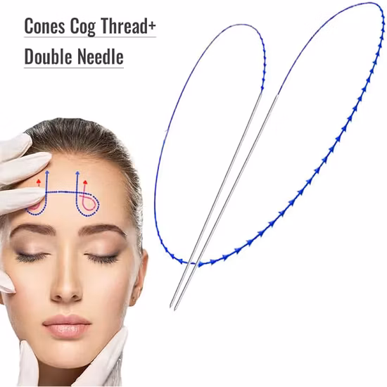 Наборы для подтяжки носа с лучшим эффектом Cog Lift Lift Pcl Pdo